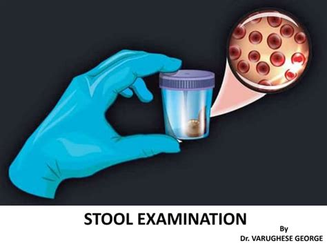 what is stool test called